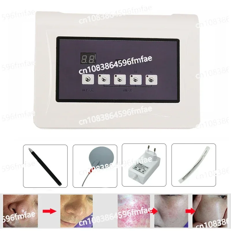 High Frequency Spider Veins Removal Machine Blood Redness Vascular Remover Beauty Equipment