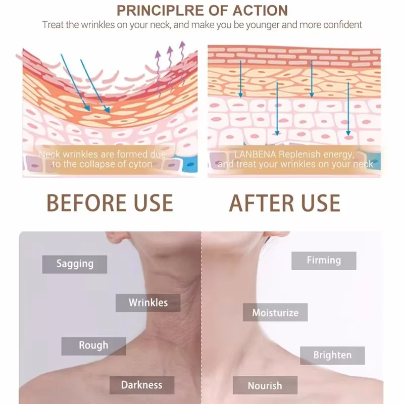 Crème anti-ridules pour le cou, raffermissante, liftante, élimine le double ruisseau, éclaircissante, lissante, hydratante, soins pour la peau