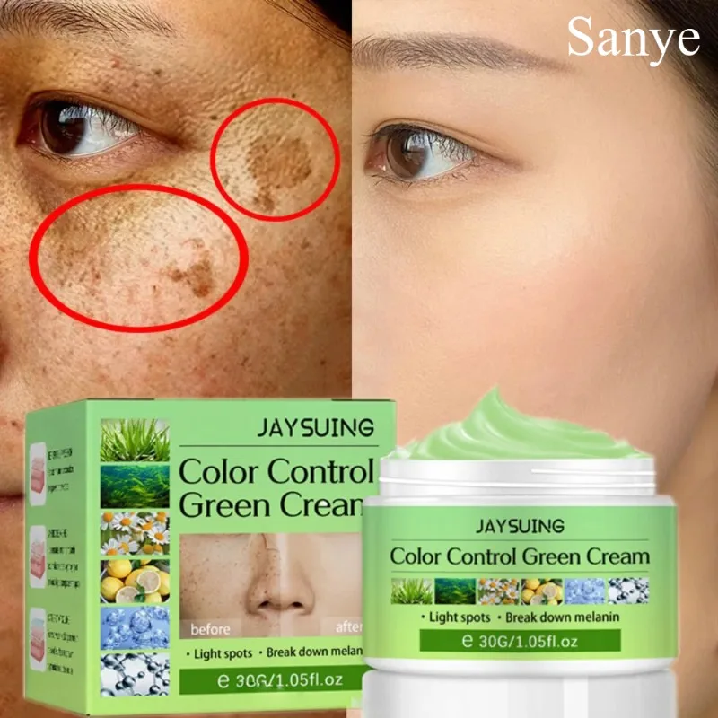 Face Whitening Freckles Cream Fast Remove Melasma Serum Lighten Melanin Dark Spots Remover Moisturizing Brighten Cream Skin Care