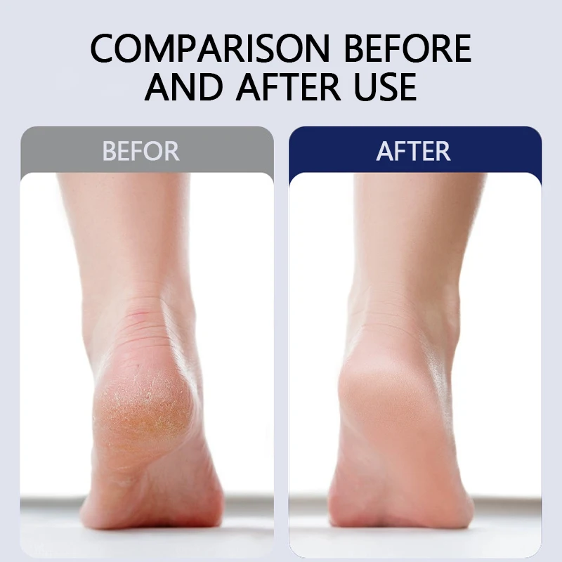 قابلة للشحن القدم طاحونة المياه برهان شاشة ديجيتال أداة باديكير ذكية كعب التلقائي فرك القدم مزيل الجلد الميت