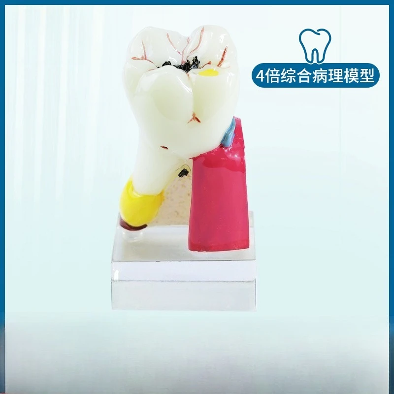 4X Comprehensive Pathology  Teaching  Dental  Oral Practice Demonstration Model
