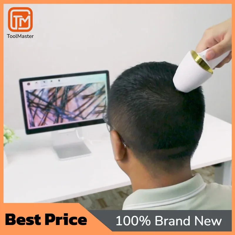 Ai Scalp Hair Loss Treatment Growth Hair Analysis Device Hair Analyzer Machine with Comparison Mode