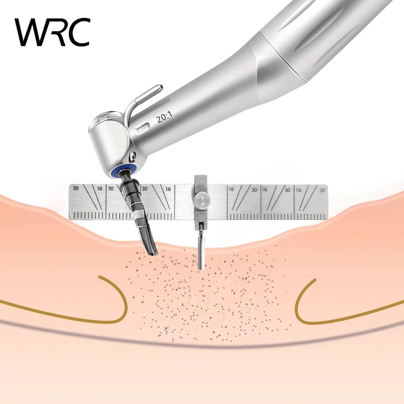 Prowadnica lokalizująca implant dentystyczny Sadzenie chirurgiczne Linijka kątowa do pozycjonowania Linijka pomiarowa Narzędzie stomatologiczne