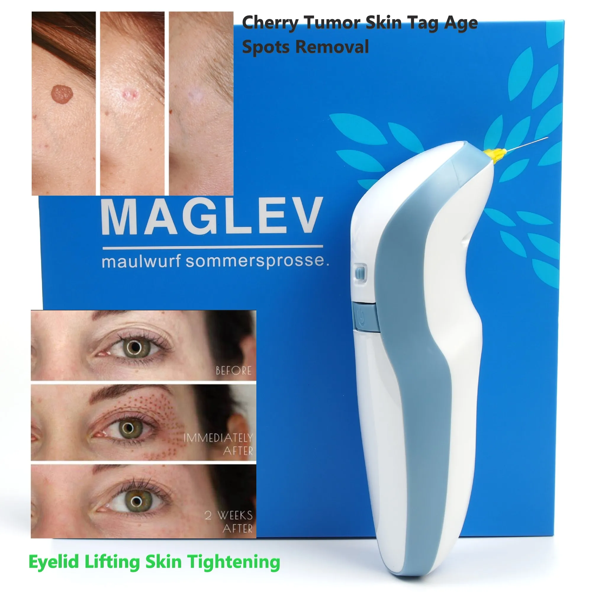 Maglev พลาสม่าแหล่งกําเนิดสินค้า Fibroblast Eyelid Lifting Dark Spot Mole Removal ความงามเครื่องกระชับผิว