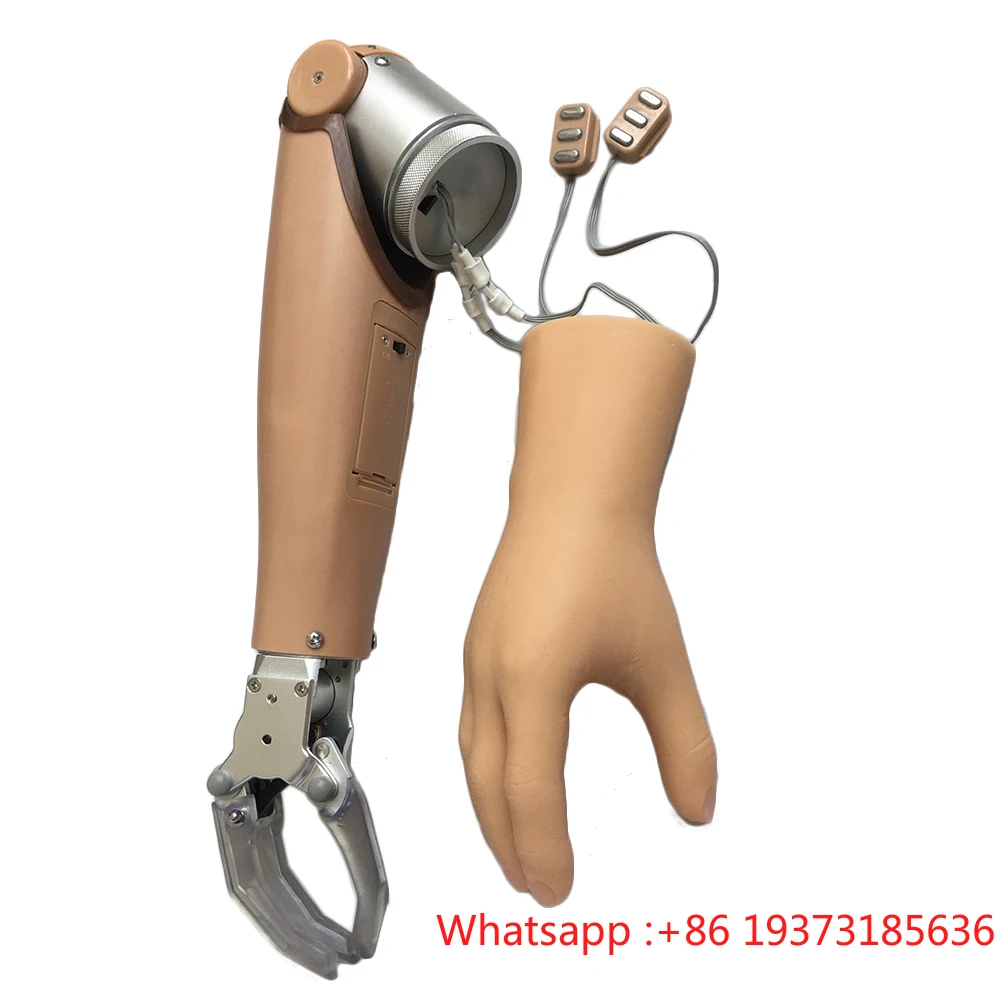 Myoelectric Arm Prostheses With Two Degrees Of Freedom For AE Prosthetic Hand