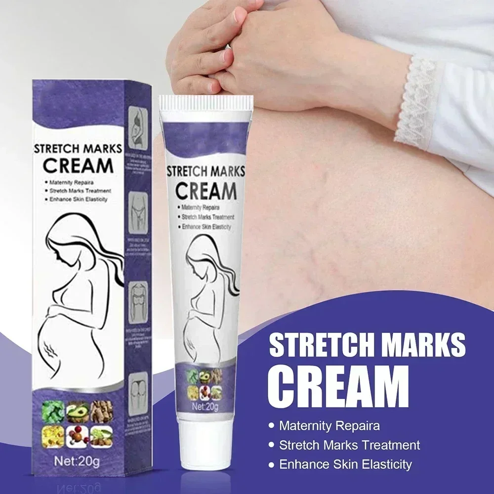 

Permanent Removal Cream Eliminate Body Belly Stretch Marks For Tunnels Effective Stretch Marks