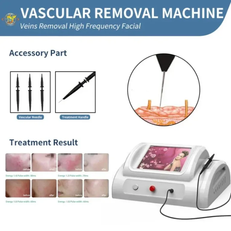 

Beauty Equipment R-F High Frequency High Frequency Treatment Ice Compress Hammer Spider Veins Vascular Removal Machine