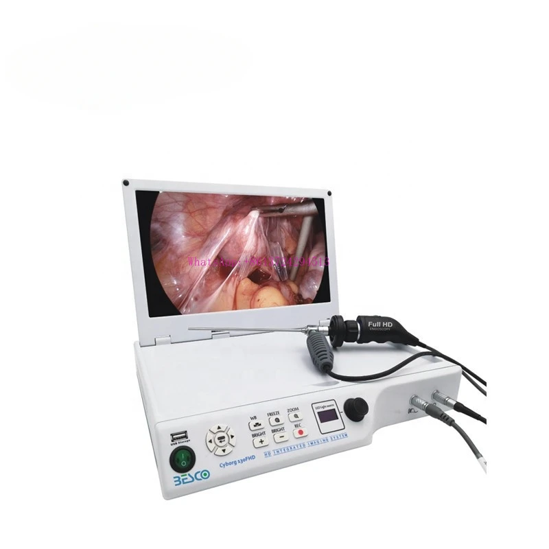 Medical Full HD Portable Intergrated Endoscopic Imaging System