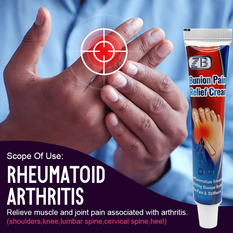 20g/pcs Thumb inflammation gout ointment is used to treat thumb inflammation, relieve itching and pain, and reduce inflammation