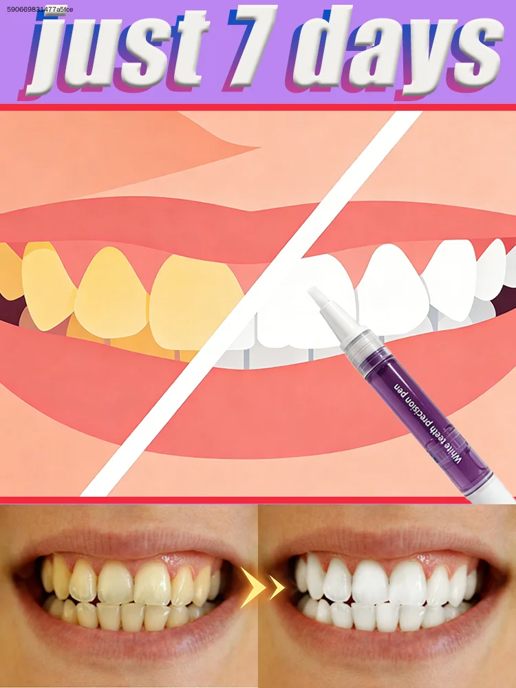 

Tᴇᴇᴛʜ Wʜɪᴛᴇɴɪɴɢ Pᴇɴ Dᴇᴇᴘ Cʟᴇᴀɴɪɴɢ Rᴇᴍᴏᴠᴇ Yᴇʟʟᴏᴡ Sᴛᴀɪɴs Oʀᴀʟ Hʏɢɪᴇɴᴇ Cᴀʀᴇ