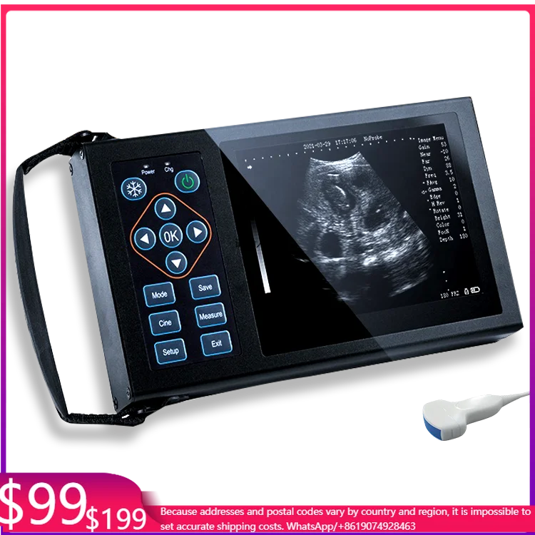 Handheld Pet Ultrasound Scanner With Image Storage Function For Veterinary Clinic And Mobile Farm Inspection