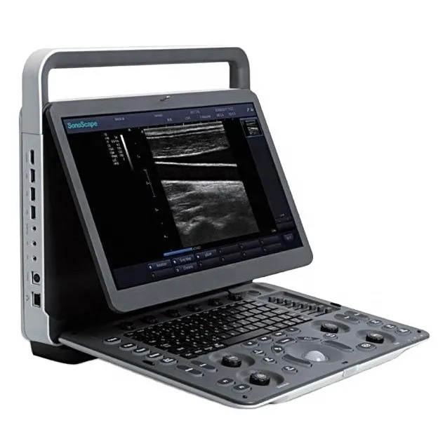 Sonoscape Color Doppler 3D 4D High Quality Portable Laptop Medical Ultrasound Machine Price Instruments E1