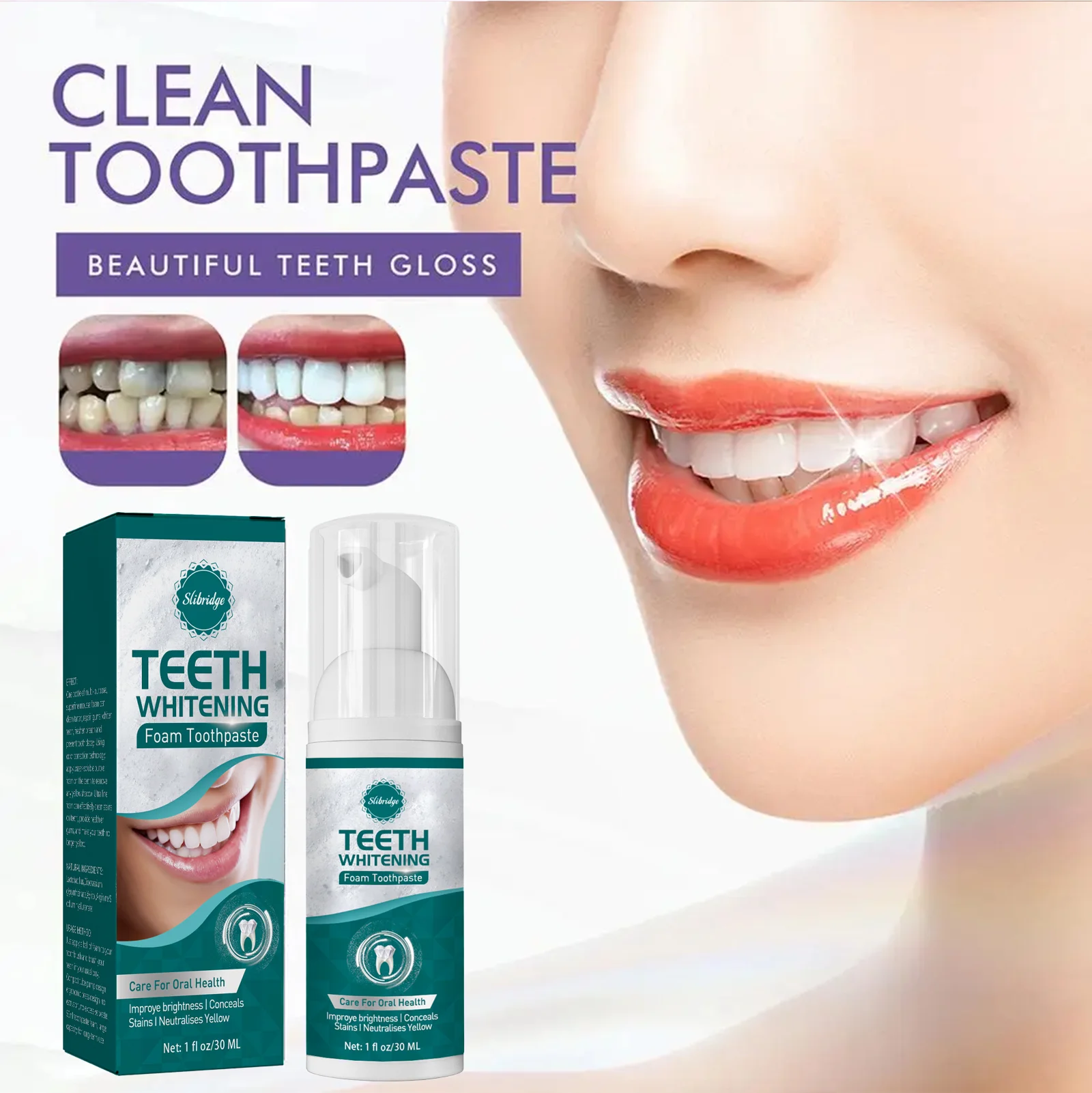 

whitening tooth paste remover dental calculus