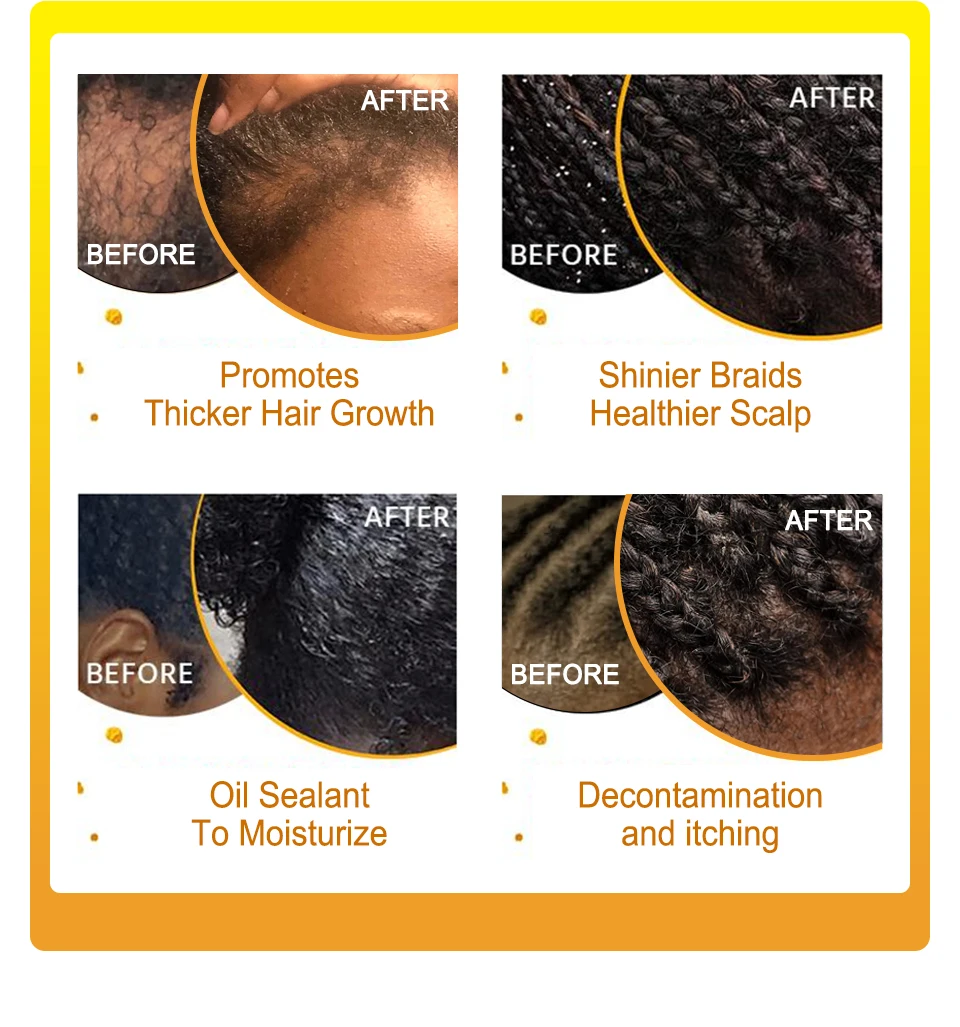 65ML olejku do włosów na skórę głowy do warkoczy ochronne fryzury łagodzą łuszczącą się i łuszczącą się skórę głowy, zapobiegając wypadaniu włosów lub przerzedzaniu