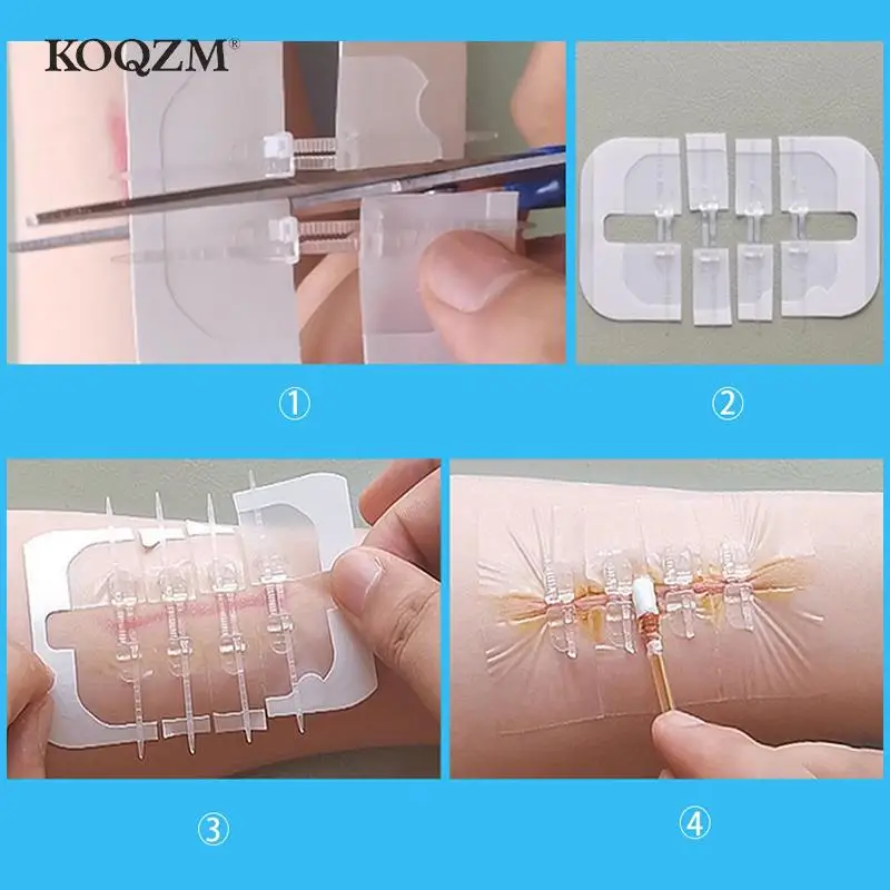 Portable Zipper Tie Wound Closure Patch Hemostatic Patch Wound Fast Suture Zipper Band-Aid Outdoor 1/3/10Pcs