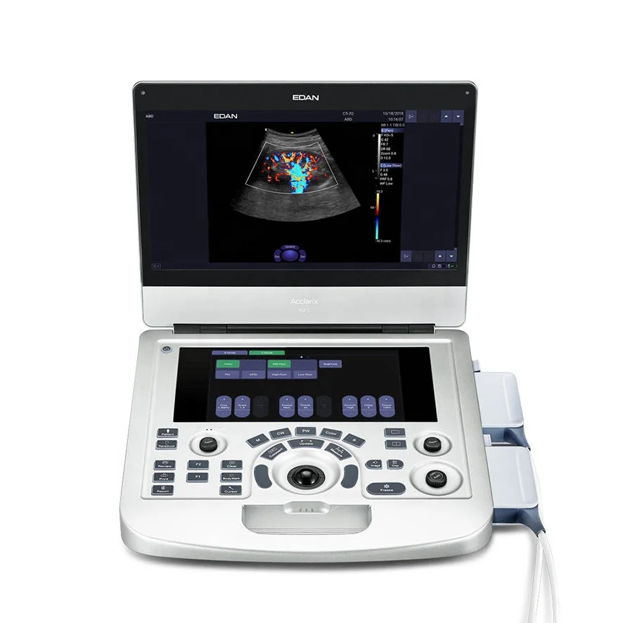 Ax3 Edan Acclarix Ax3 Ax8 Echocardiography Ultrasound Machine Price For Obstetrics Gynecology Pediatrics Urology