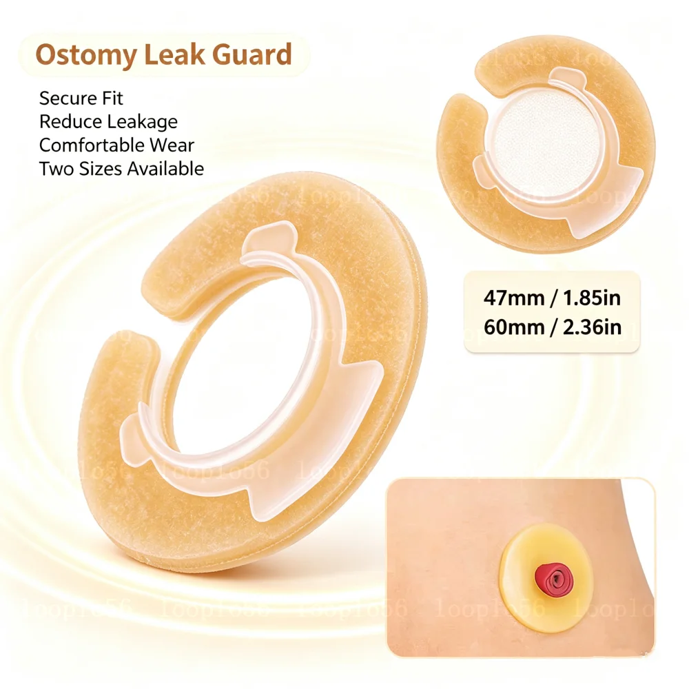 Barrier Stoma Ostomy Strips Tape Skin Supplies Strip Rings Nursing Adhesive Pressure Fixing Colostomy Leak Proof Ileostomy Pouch