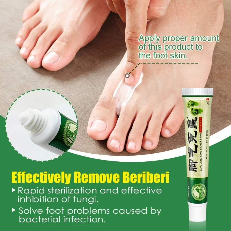 Crème de traitement pour les pieds Tinea Pedis, pommade béribéri soucieux, anti-démangeaisons, inhibe les champignons, peeling des pieds d'athlète, crème médicale, A942, 5 pièces