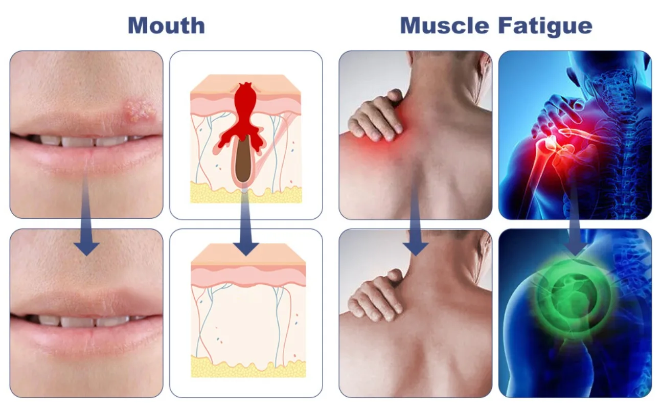 الضوء الأحمر مصباح يدوي دليل العمود الأشعة تحت الحمراء فحص الفم LED معدات الإضاءة 850nm باليد العلاج الطبيعي المساعد