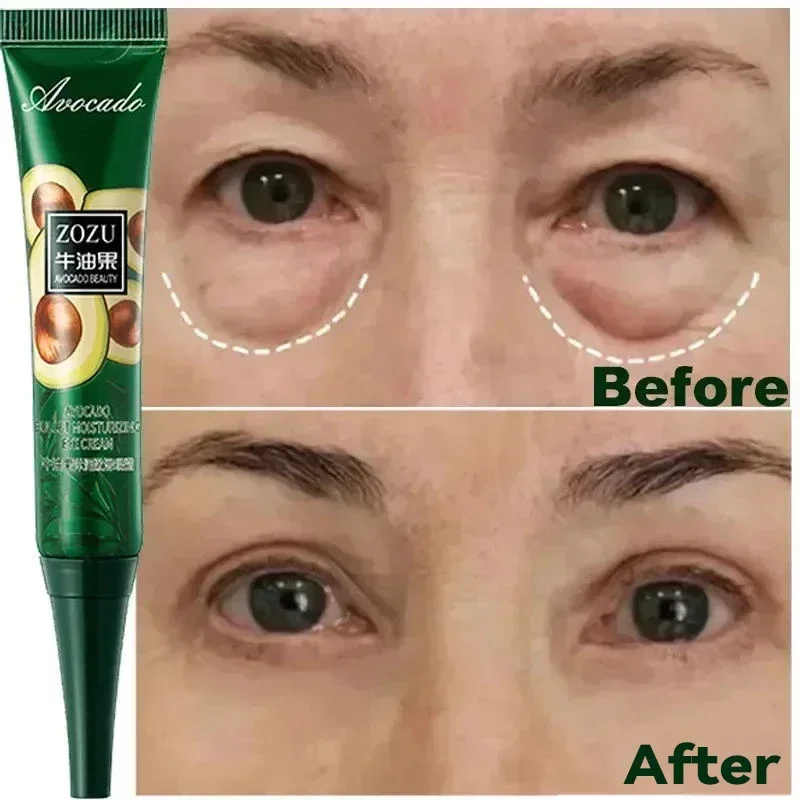 7 Day Tighten Wrinkles Eye Cream Eye Fine Line Whiten Under Eyes Skin Korean Care Anti Dark Circles Bags Puffiness Fade New 2024