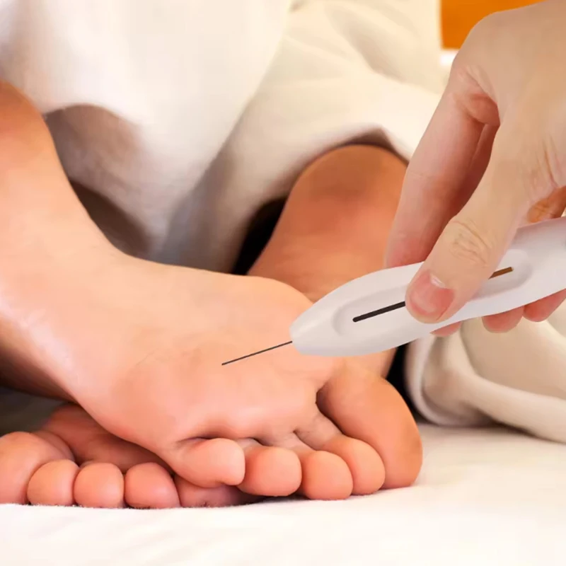 

Medical 10g Nylon Diabetic Monofilament Sensory Tester Skin Foot Nerve Needle Pen Endocrinological Neurological Diagnostic Pen.