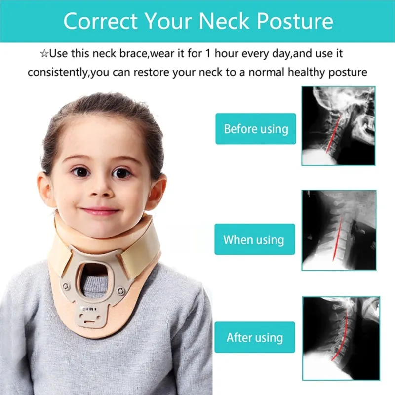 Postoperative support and neck protection for children with neck brace and skewed neck corrector baby with skewed head baby with