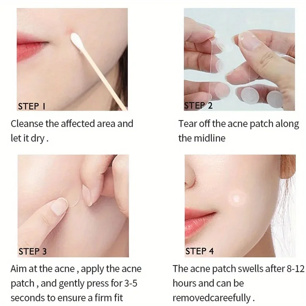 72 قطعة حب الشباب التصحيح احمرار الوجه ترطيب وسلس الجلد حب الشباب إصلاح حب الشباب نظيفة المسام التصحيح ملصقات الوجه أدوات العناية بالبشرة