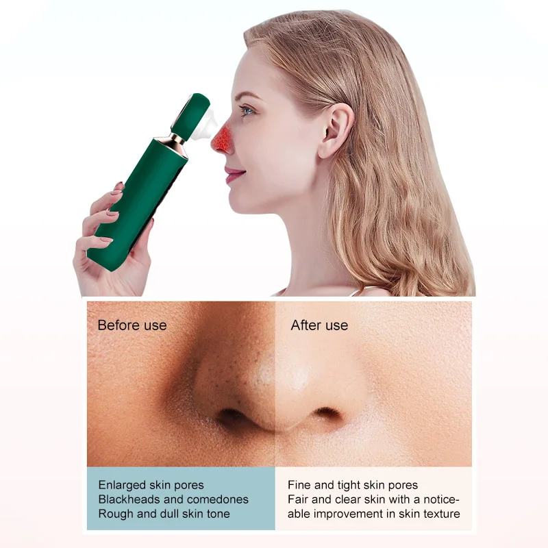 منظف مسام الوجه للرؤوس السوداء الكهربائية مع مكبر للرؤوس السوداء للرجال والنساء #5