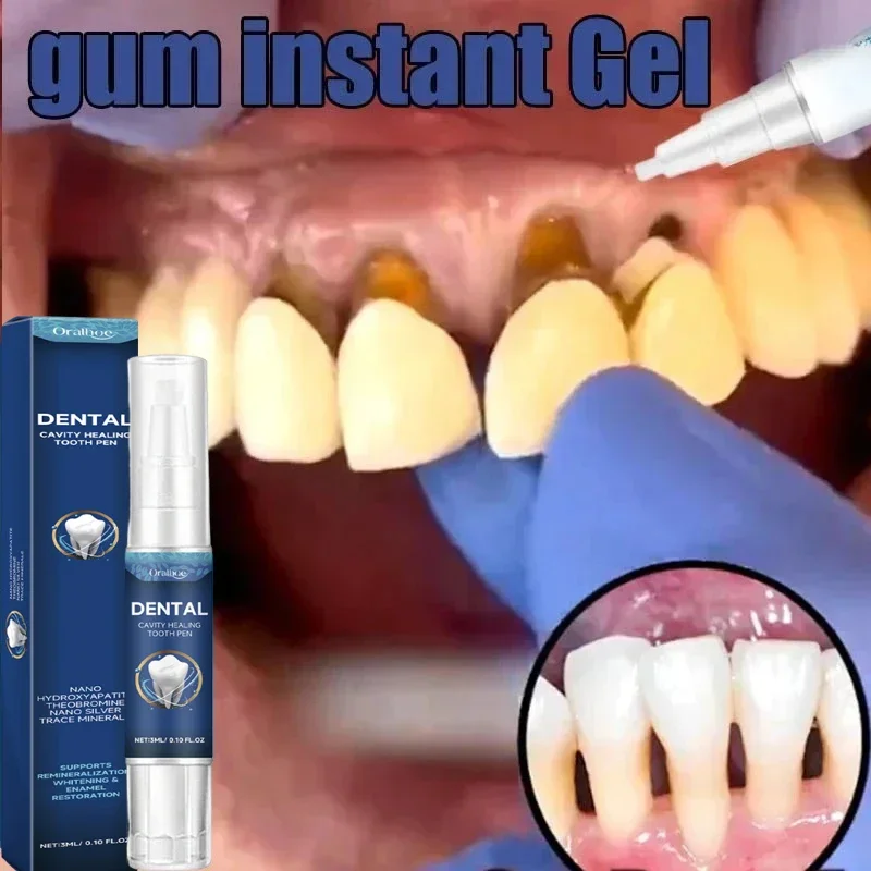 Rapid Repair Damaged Gums Gel Serum Relieve Sore Tooth Allergy Dental Caries Tooth Cleaning Toothpaste Deep Cleaning Teeth Stain