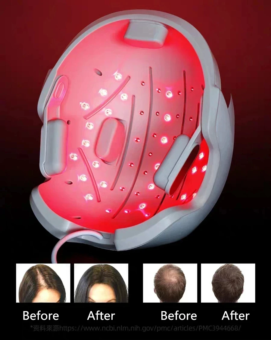 Lescolton Men Hair Growth Cap LLLT Helmet Laser Hair Regrowth Hair Loss Laser Treatment Hair Fast Growth Anti Hair Loss Machine