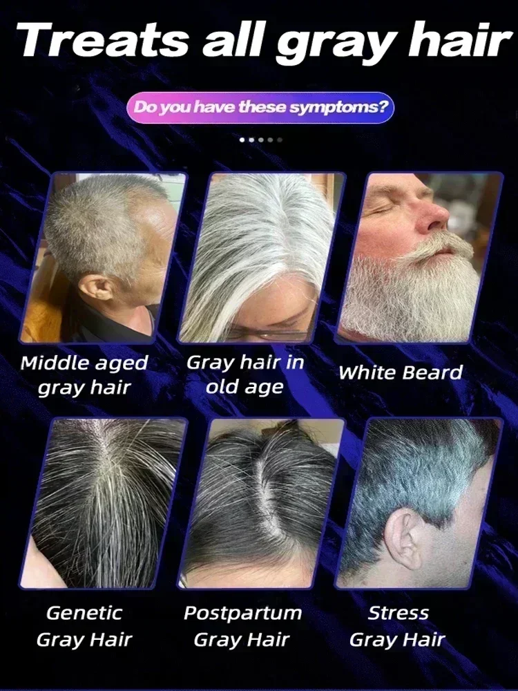 White hair killer, remove gray hair and restore natural hair color in 7 days Healthy,quickly turns white airh into black