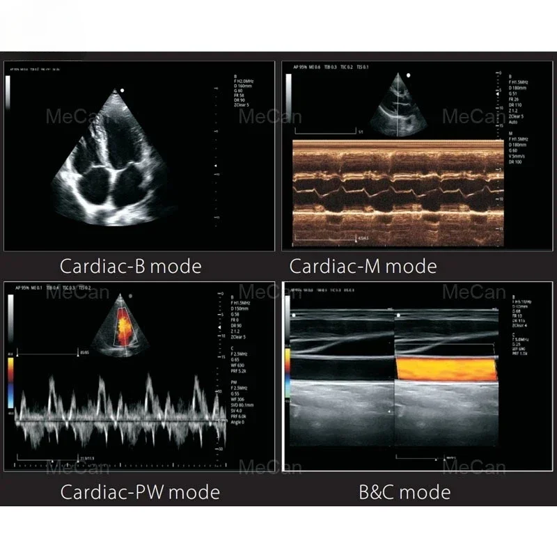 Medical Ecografo Echo Portable 3D Color Doppler Ultrasound Echocardiography Machine Portable Ultrasound Scanner for Human Being