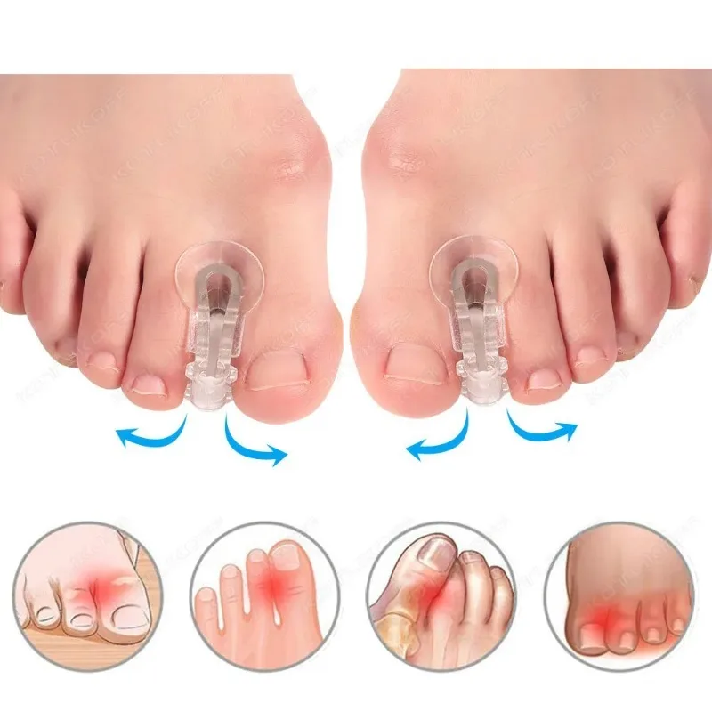 Hallux Valgus Corrector 1Pair Soft Silicone Gel Big Toe Separator Prevent Overlapping Toes Thumb Toe Protector Foot Care Tool