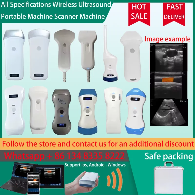 Portable Wireless Ultrasound Probe Scanner Portable Machine WIFI Ultrasound Scanner Machine Sonostar Brand Factory