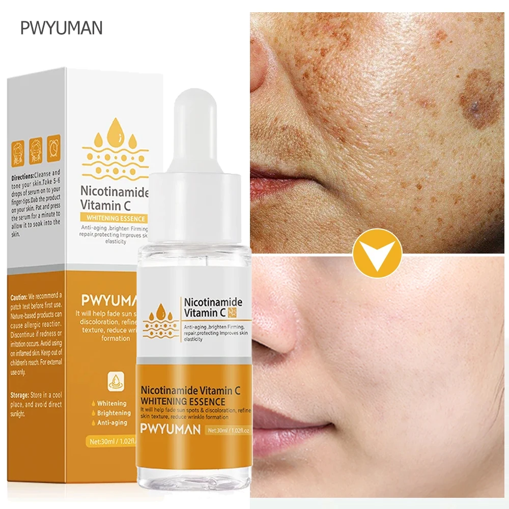 Vitamin C Whitening Face Serum For Dark Spots Freckles Remover Essence Fade Melasma Melanin Brighten Dull Skin Care Cosmetics