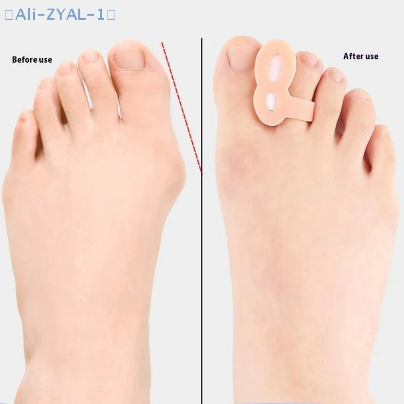 【ZYAL-1】1 Pair Toe Separator Bunion Corrector Gel Toe Spacer Toe Protector Relief Pain From Bunion Overlapping And Drifted Toe