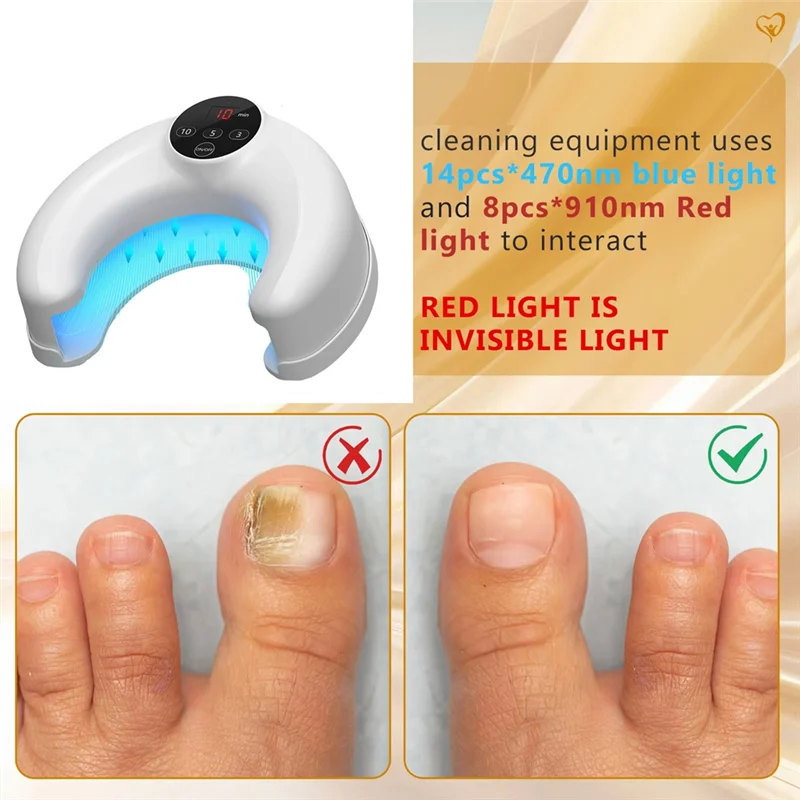 Anti Infection Paronychia Onychomycosis Grow Toe Nail Wireless Nail Fungus Laser Device 14Pcs 470Nm Blue Light Toenails