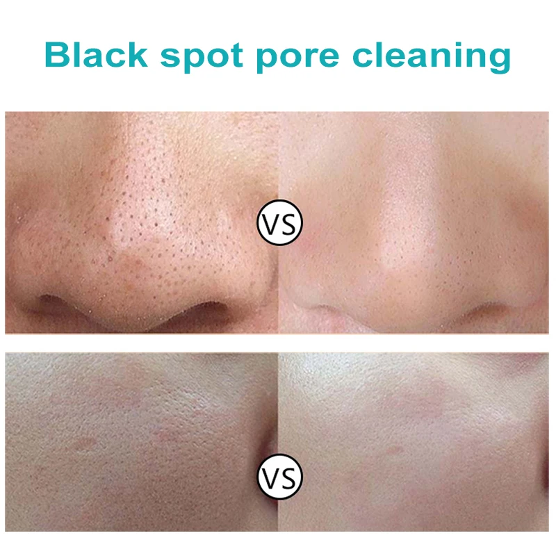 Naso Comedone Uscita Liquido Pulizia Profonda Cura Della Pelle Cura Della Pelle Restringimento Dei Pori Trattamento Dell'acne Maschera Macula Spot Pore Cleaner 400ml