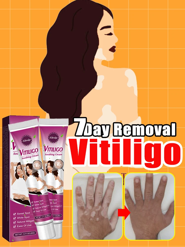 

Elimination of skin vitiligo