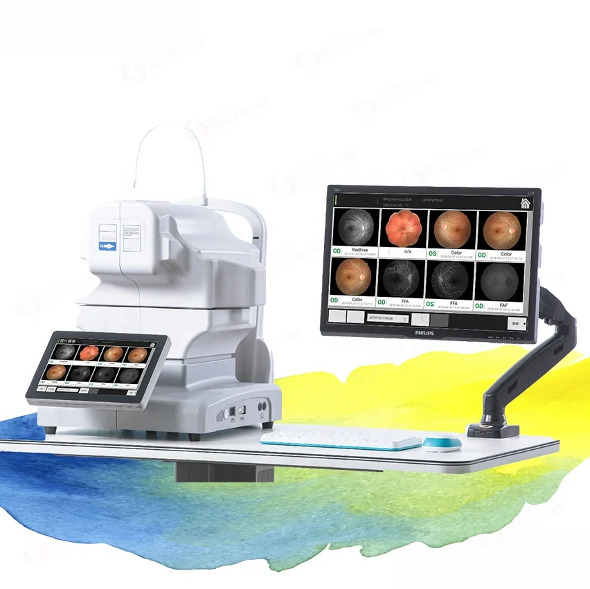 China 3D Hr Digital Automatic Non-Mydriatic Fundus Camera with FFA/FAF