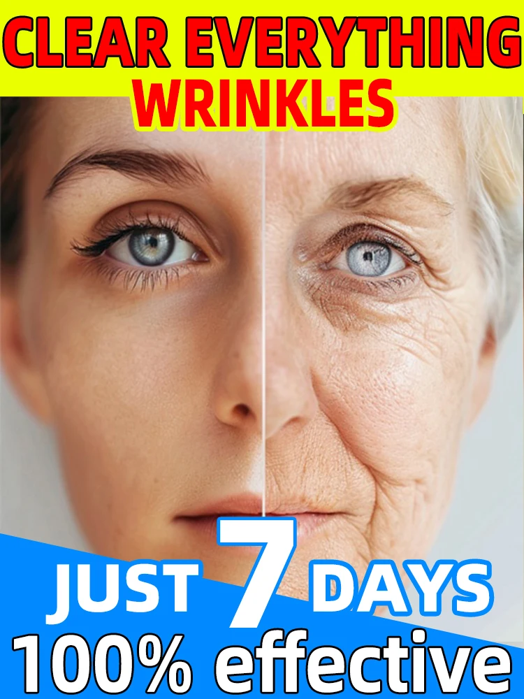 

Electric Face wrinkle