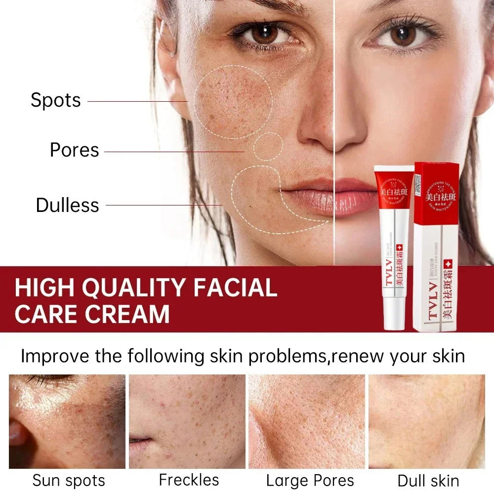 Whitening Freckle Cream Melasma Dark Spots Pigmentation Removal Products Fade Stain Melanin Repair Brighten Korean Skin Care