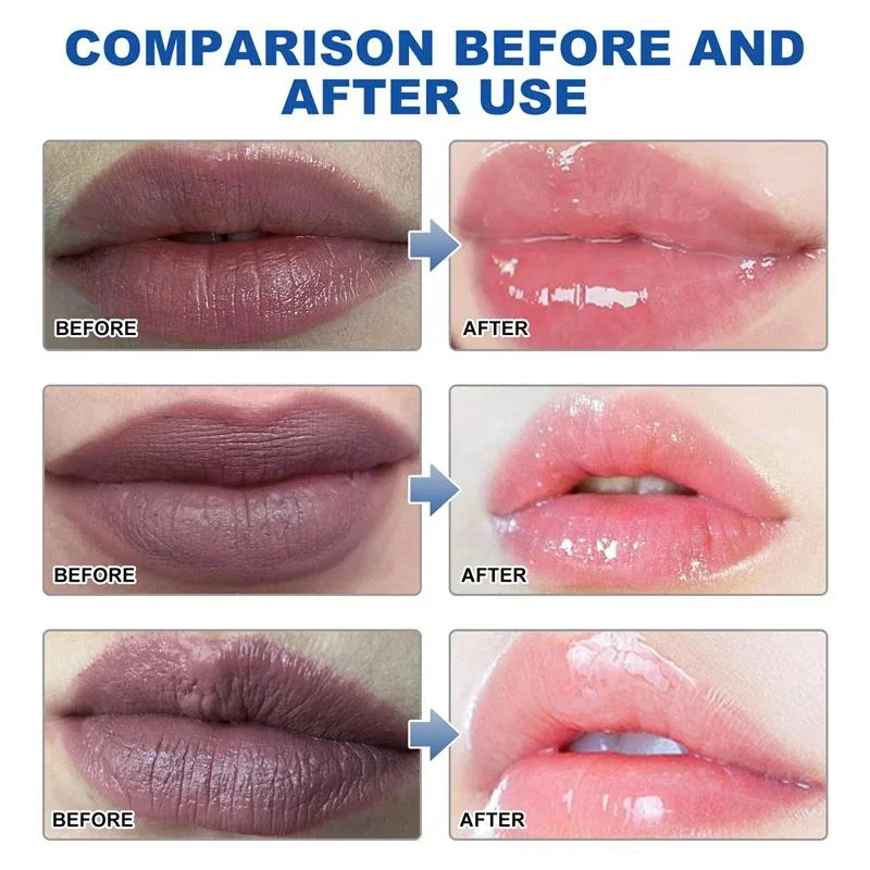 Entfernen dunkle Lippen Serum aufhellen Melanin Lippen maske Peeling verblassen Lippen linie abgestorbene Haut feuchtigkeit spendend aufhellen Reparatur Lippen pflege produkt