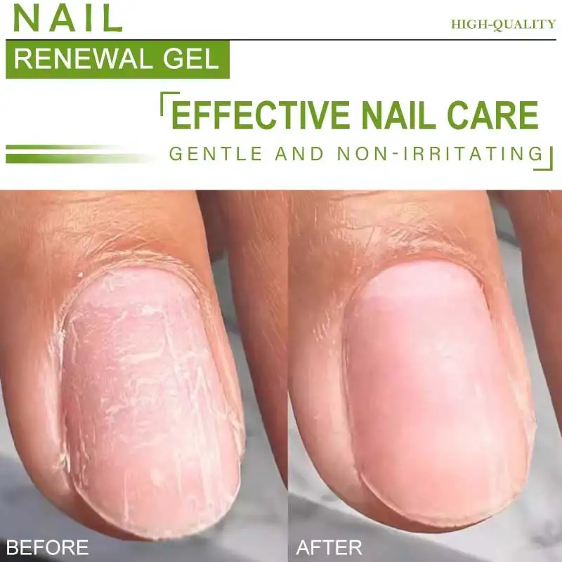 Żel do regeneracji paznokci z keratyną, preparat na porost paznokci, wzmacniacz paznokci, serum naprawcze w płynie 20g, zdrowa pielęgnacja dłoni, stóp i paznokci.