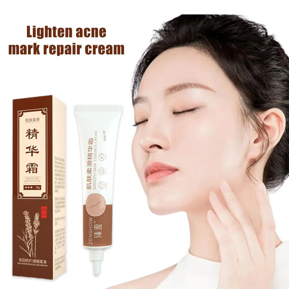 Crema para eliminar marcas de estiramiento, para la piel crema reparadora, aclaramiento de cicatrices, acné, tratamiento para puntos negros y acné, crema blanqueadora para el cuidado de la piel, 20g