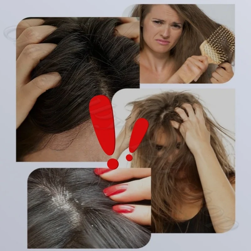 Le 8 フラッフィー オイル コントロール シャンプー プラント エッセンス 香りを改善し、乾燥した滑らかな髪と香りの持続性を向上させます 258ML