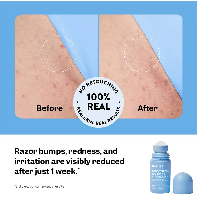 Hair Removal Soothing Essence Moisturizer Gentle Repair Lasting Refresh Deep Nourishing Lubricat Skin Rejuvenation Rolleressence