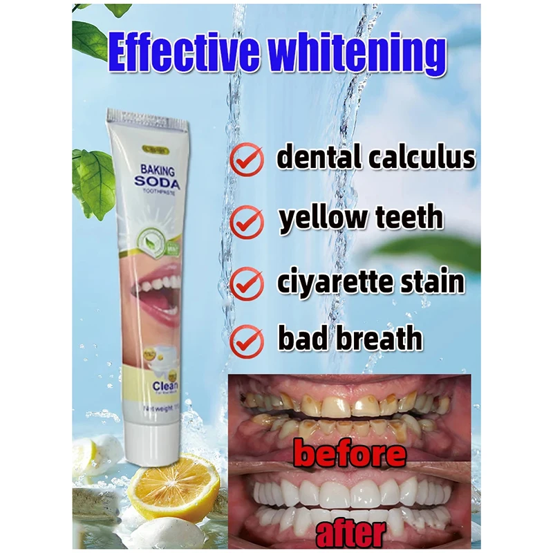 Remover Dental Calculus Toothpaste Preventing Periodontitis Removal Bad Breath Remove Yellow Teeth Cleansing Care Toothpaste