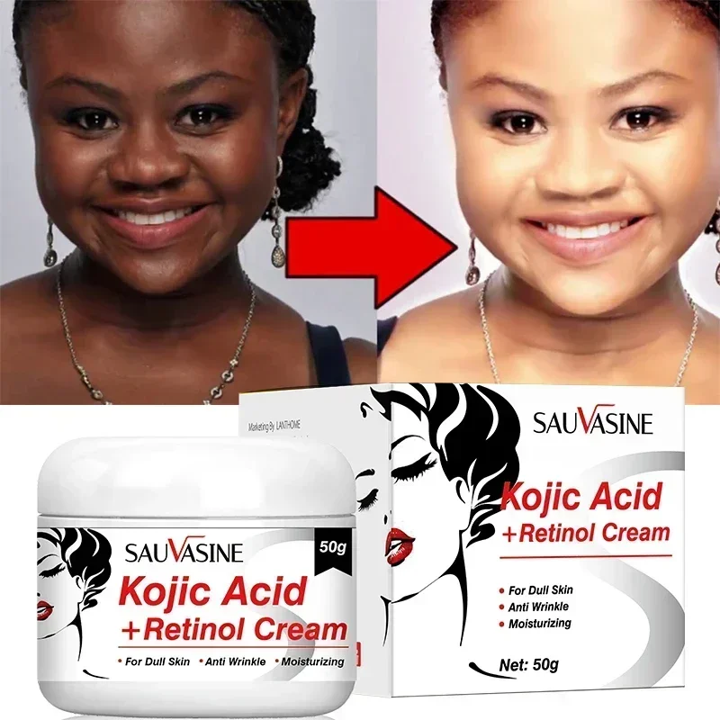 Creme clareamento ácido kójico, remover pigmento, melanina, manchas escuras, nutrição, resurfacing, desvanecer-se cuidados com a pele, creme facial