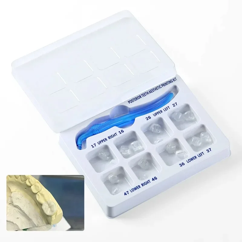 

Dental Posterior Teeth Aesthetic Printing Mould Kit Light Cure Composite Restoration Filling Resin Dentistry Remodeling Tools